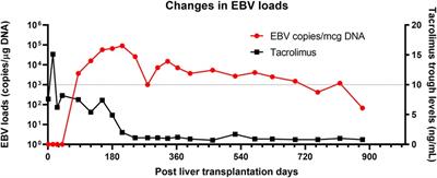 Chronic Epstein-Barr viral load carriage after pediatric organ transplantation